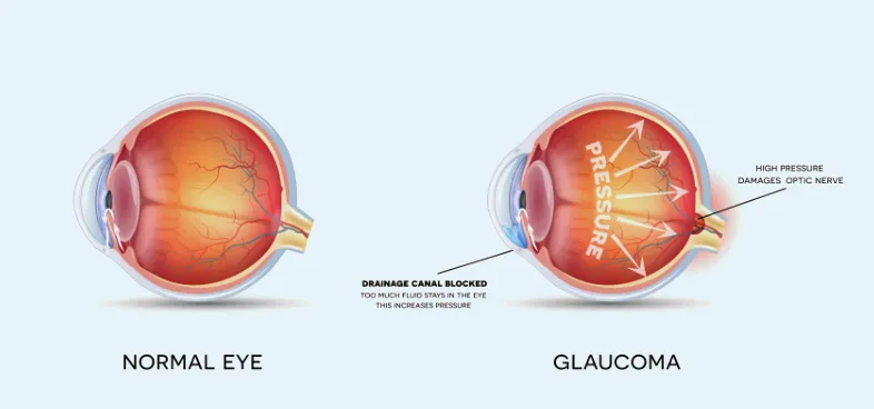 eye hospital
